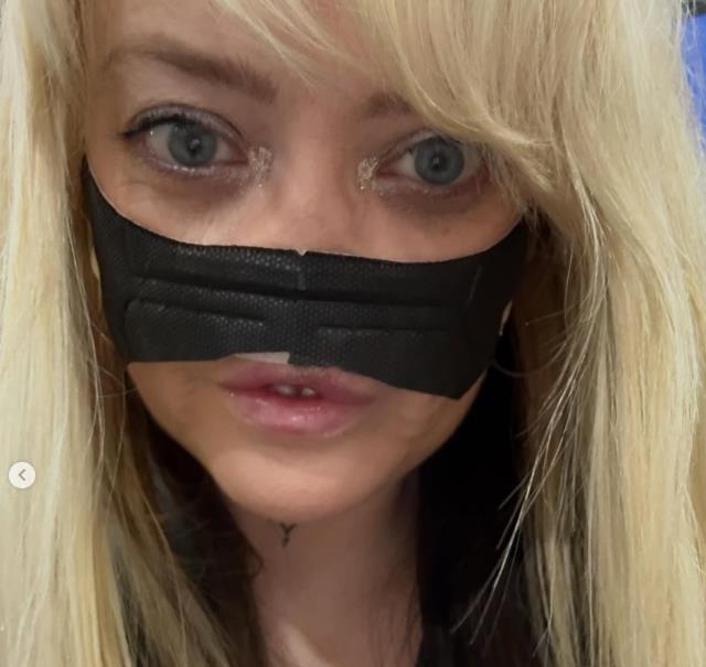 Lin Ebejans - otišla u Tursku da uradi zube, vratila se sa infekcijom