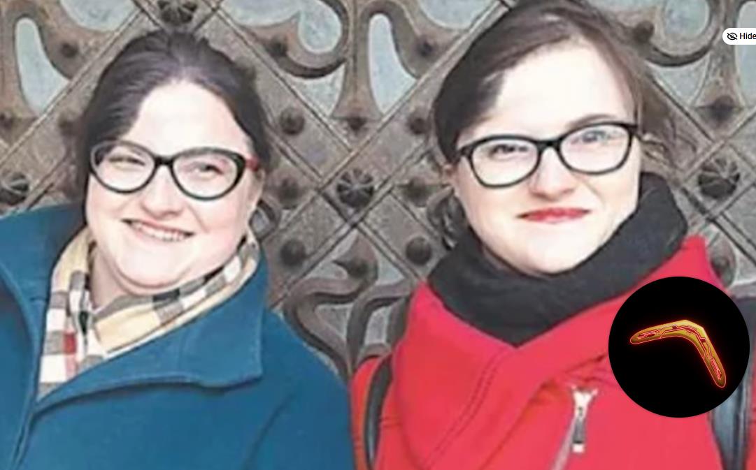 Sijamske bliznakinje Vilija i Vitalija - odrasle