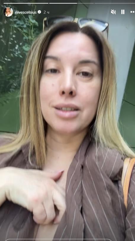 Nives Celzijus pokazala osip i crvenilo po koži