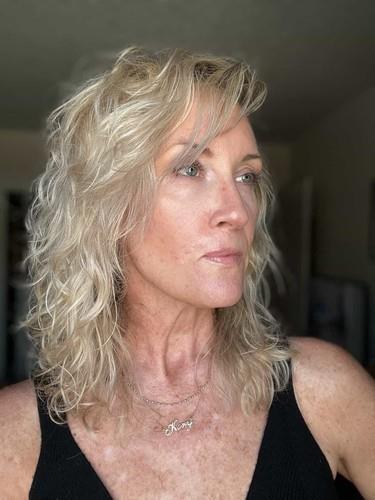 Kori Felc - probudila se tokom operacije raka kože na usni