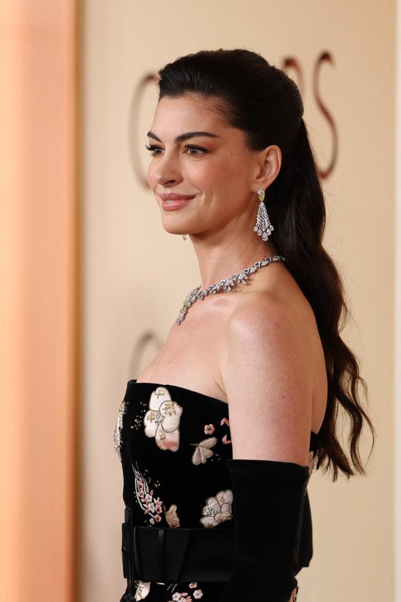 En Hatavej na crvenom tepihu Oskara 2026 izazvala pažnju zbog izgleda lica