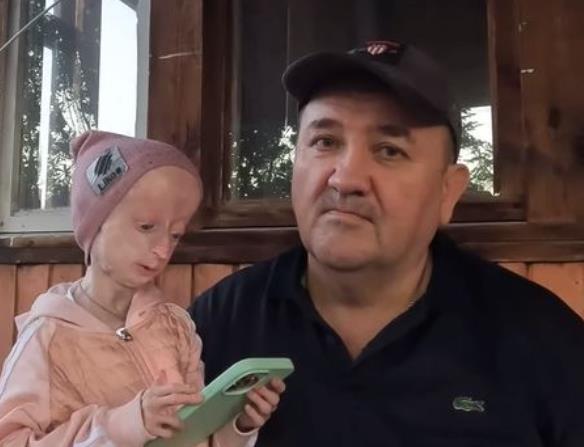 Anja Korčagina, devojka čiji je život obeležen progerijom