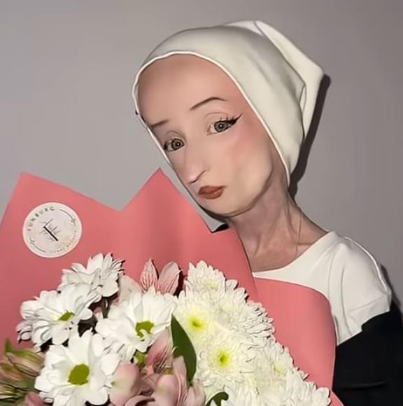 Anja Korčagina, devojka čiji je život obeležen progerijom