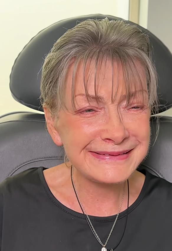 Žena posle fejsliftinga sa drastičnom promenom izgleda (2).png