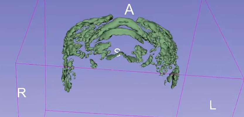 fileri, magnetna rezonanca