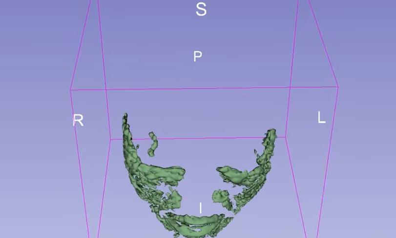 fileri, magnetna rezonanca