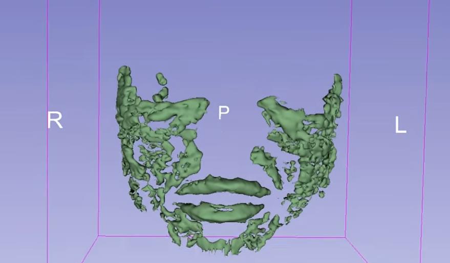 fileri, magnetna rezonanca