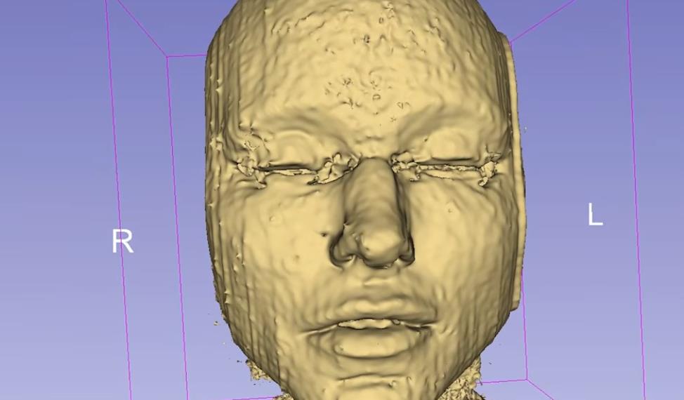 fileri, magnetna rezonanca