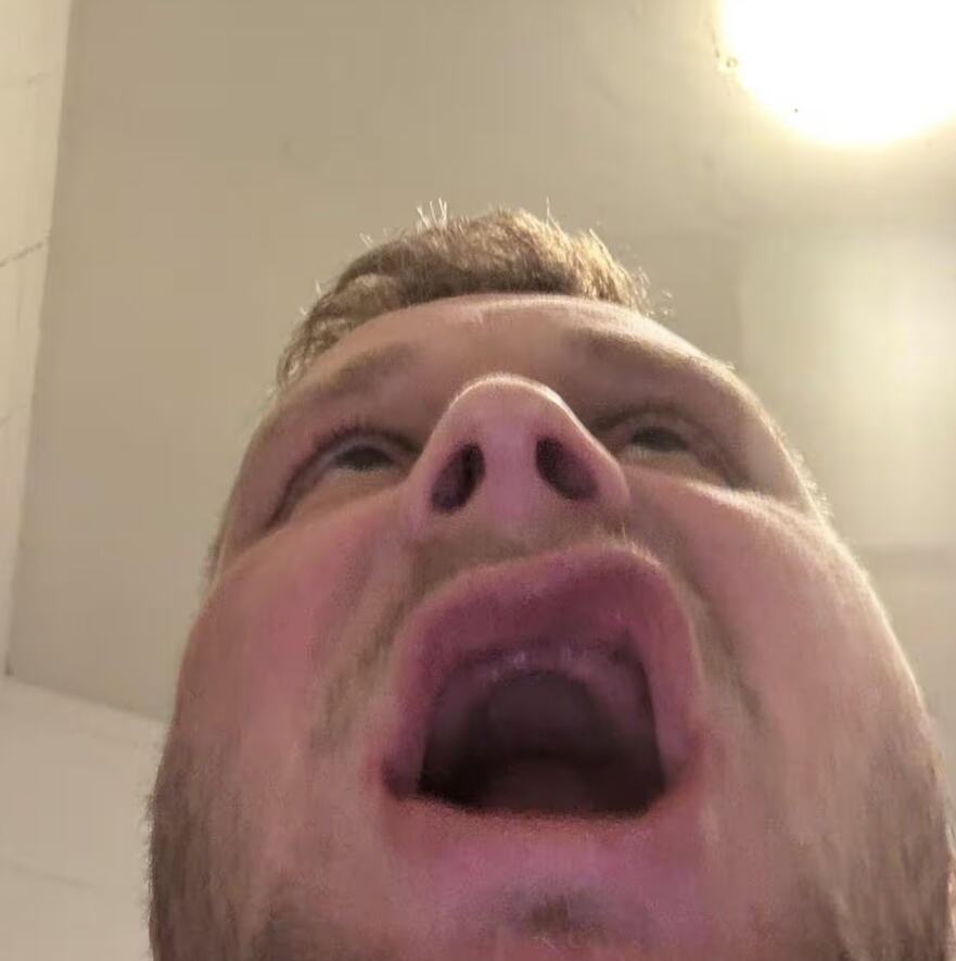 Džon Denton ostao bez zuba u Turskoj (8).png