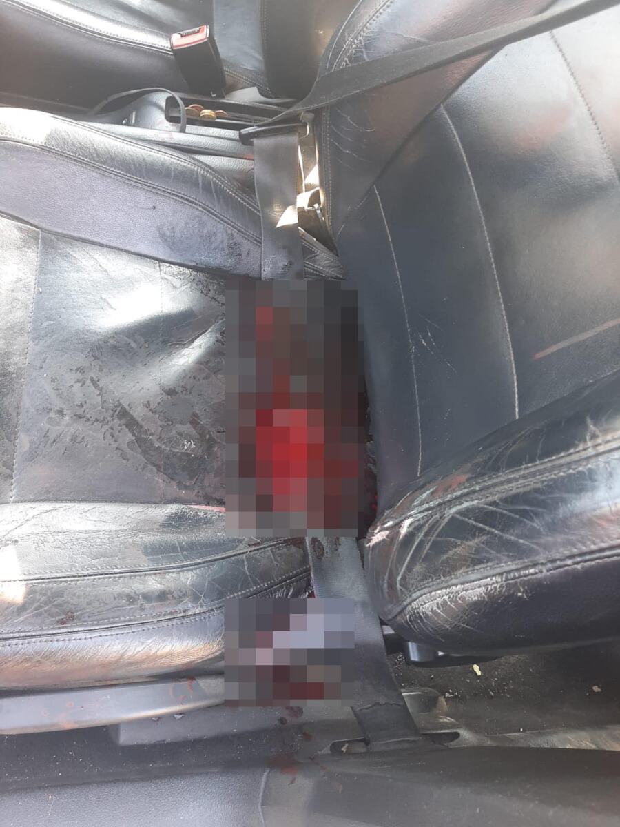 Šid maloletnica izbola mladića