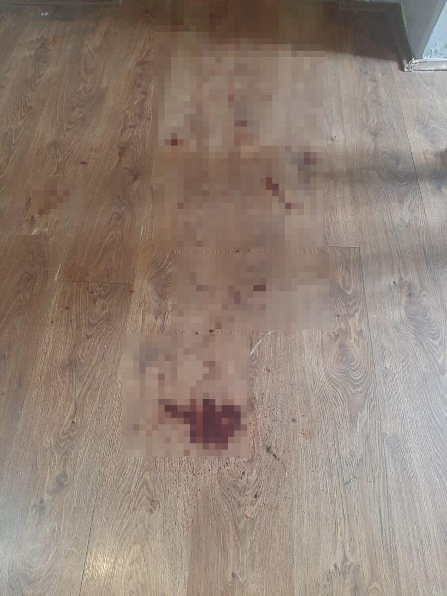 Šid maloletnica izbola mladića