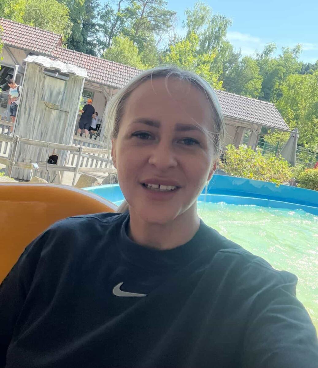 Anamarija Čolte - iskustvo sa operacijom zuba u Turskoj