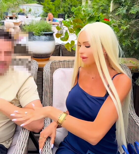 Milica Polskaja pokazala deku i slike pre operacija