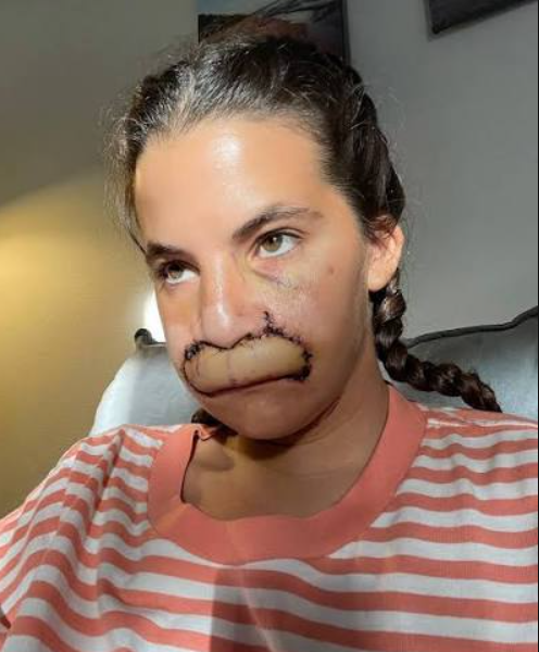 Bruklin Kuri ujeo pas za lice (2).PNG