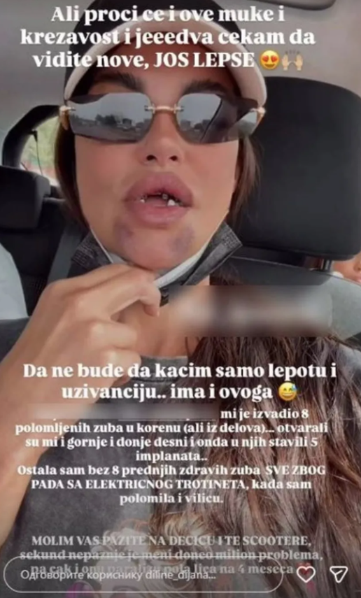 Dijana Dilajn slomila vilicu, izvadili joj osam zuba