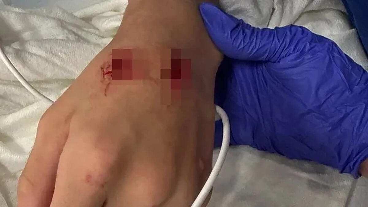 savage-attack-boy-13-brutally-1108804952.jpg