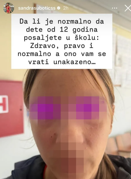ALEKSANDRA SUBOTIĆ TVRDI DA JOJ JE ĆERKA PRETUČENA! Uznemirujuće fotografije: Ima ogrebotine po licu i vratu