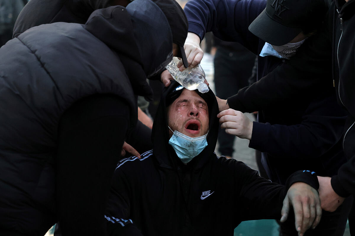 Albanija protesti demonstracije (1).jpg