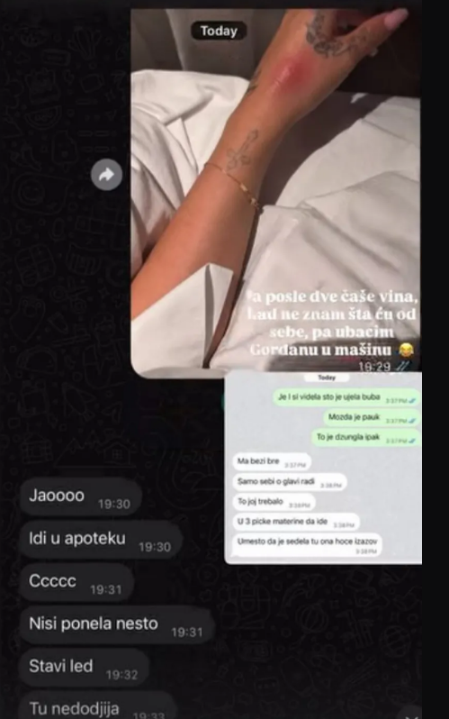 PEH ZA PEHOM! Džehva otišla na luksuznu destinaciju pa je izujedale bube i cela izgorela: Onda joj se mama Gordana obratila