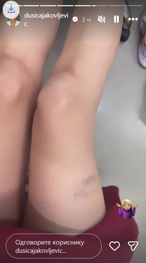 DUŠICA JAKOVLJEVIĆ SE STROPOŠTALA NIZ STEPENICE: Voditeljka u krvi i modricama: Da mi je neko rekao... (FOTO/VIDEO)