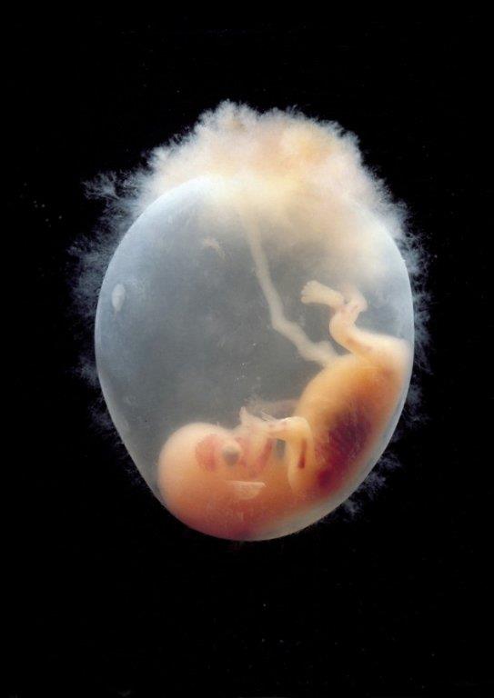 fetus-10.jpg