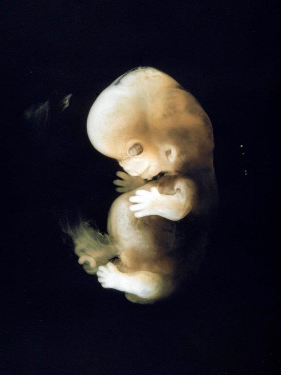 fetus-11.jpg