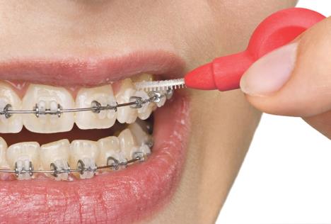 stockphotobeautifulteethwithperfectoralhygiene101867878.jpg