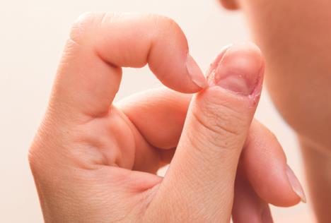 stockphotocloseupofinjuredfemalefingerafterbitingnails411247918.jpg