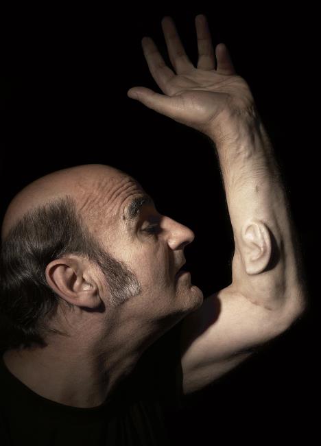 2.-ear-on-arm-stelarc--photographer-dean-winter.jpg