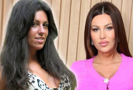 Stanija potrošila 18.700 € na operacije