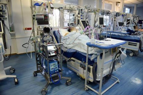 ecmo-aparat-sa-leve-strane-i-pacijentkinja--3.jpg