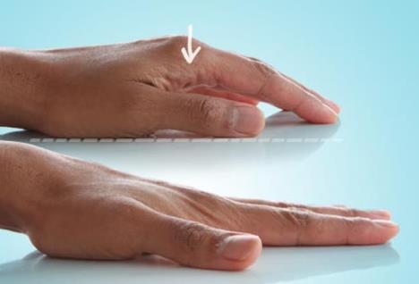 2-webmd-rf-photo-of-finger-stretch.jpg