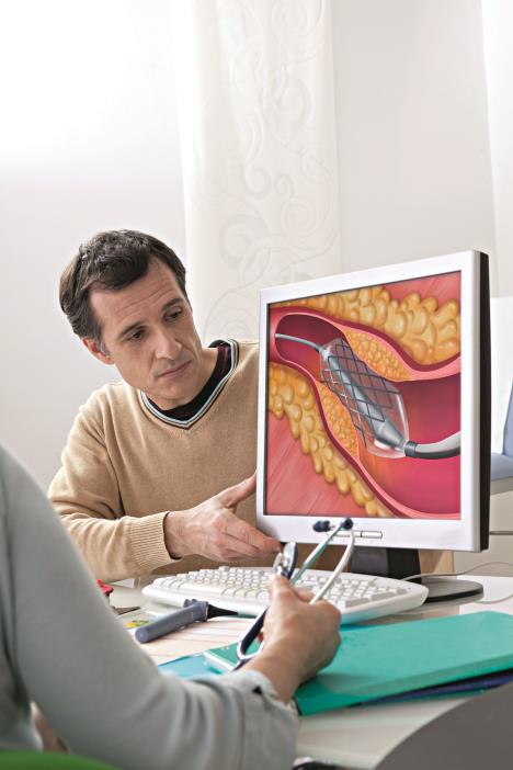 krvni-sudovi--stockphotocardiologyconsultationman171517532.jpg