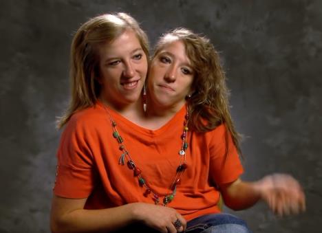 Ebi i Britani Hensel u narandžastoj majici