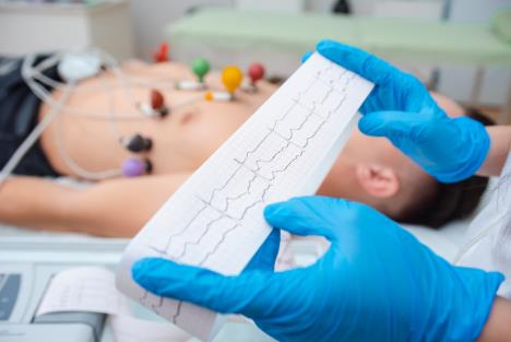 ekg-srca-shutterstock-1919282816.jpg