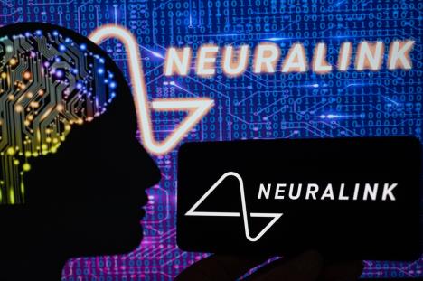 shutterstock-neuralink-3.jpg