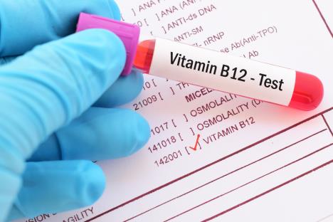 vitamin-b12--test-shutterstock-755578255.jpg