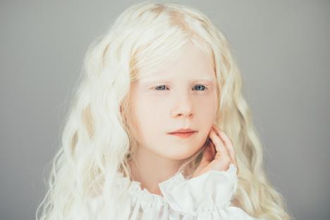 albino-deca-shutterstock-1891973785.jpg