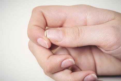lomljivi-nokti-shutterstock-1288458007.jpg