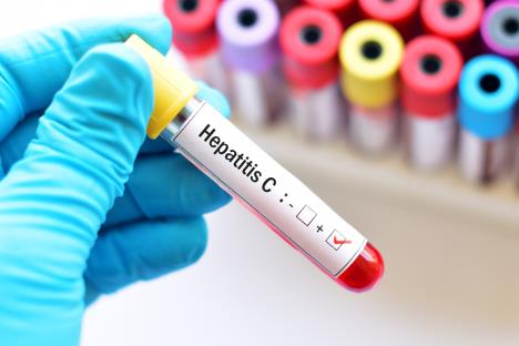 hepatitis-shutterstock-735489400.jpg