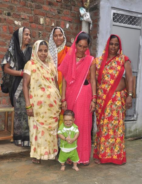 Ravi Kumar, odrastao čovek u telu deteta.jpg