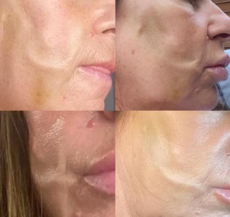 Screenshot 2025-02-14 094143.png