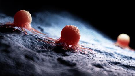 celije raka shutterstock_1176407548.jpg