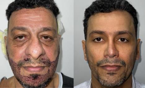 Transofrmacije koje su šokirale svet