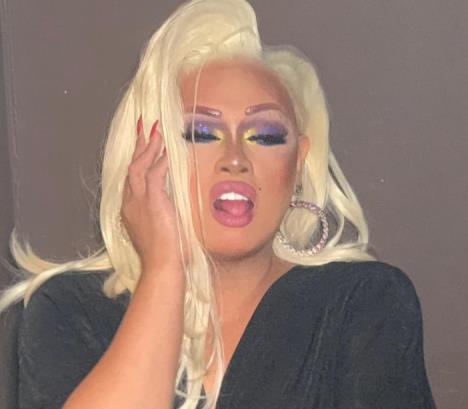 Džigli Kaliente amputirana noga