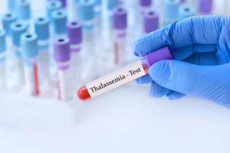 talasemija shutterstock_2480883499.jpg