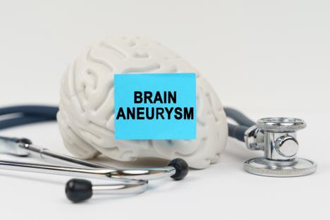 aneurizma shutterstock_2389194227.jpg