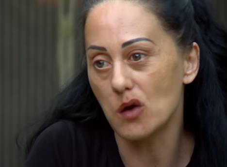 Biljana Černić zbog promaje dobila paralizu lica