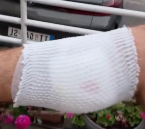 Sajfer pokazao ranu.png