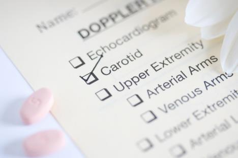 dopler karotida shutterstock_1962002374.jpg